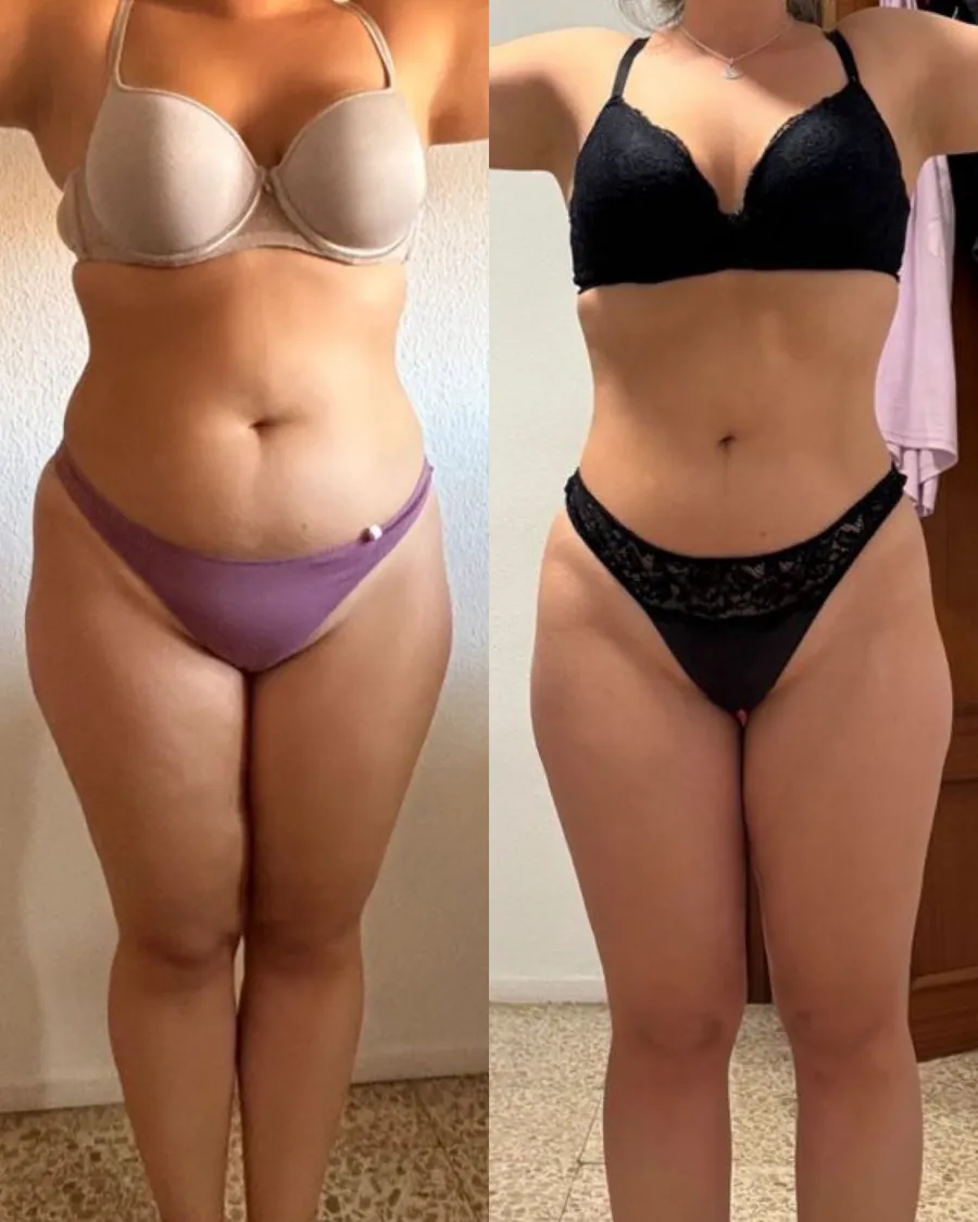 Antes y después de una clienta