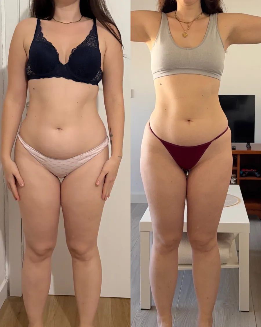 Antes y después de una clienta