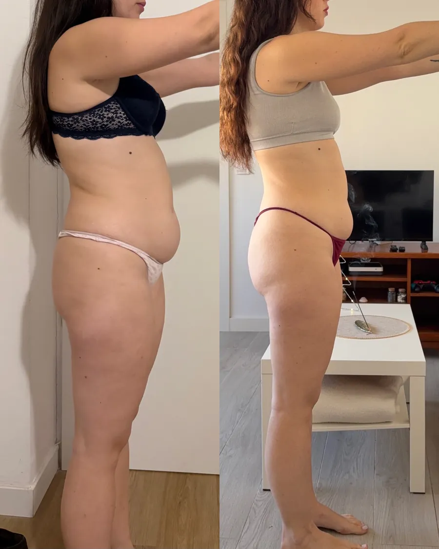 Antes y después de una clienta