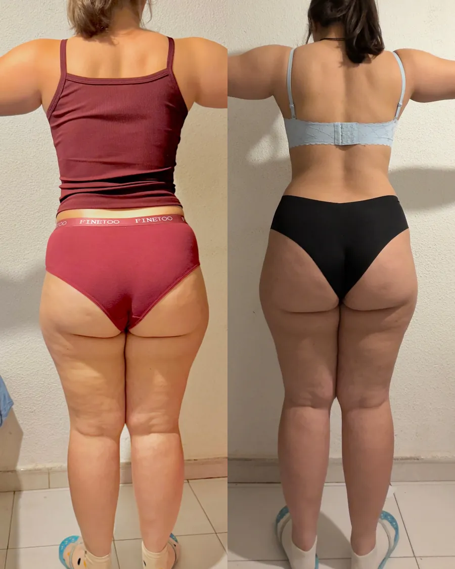 Antes y después de una clienta