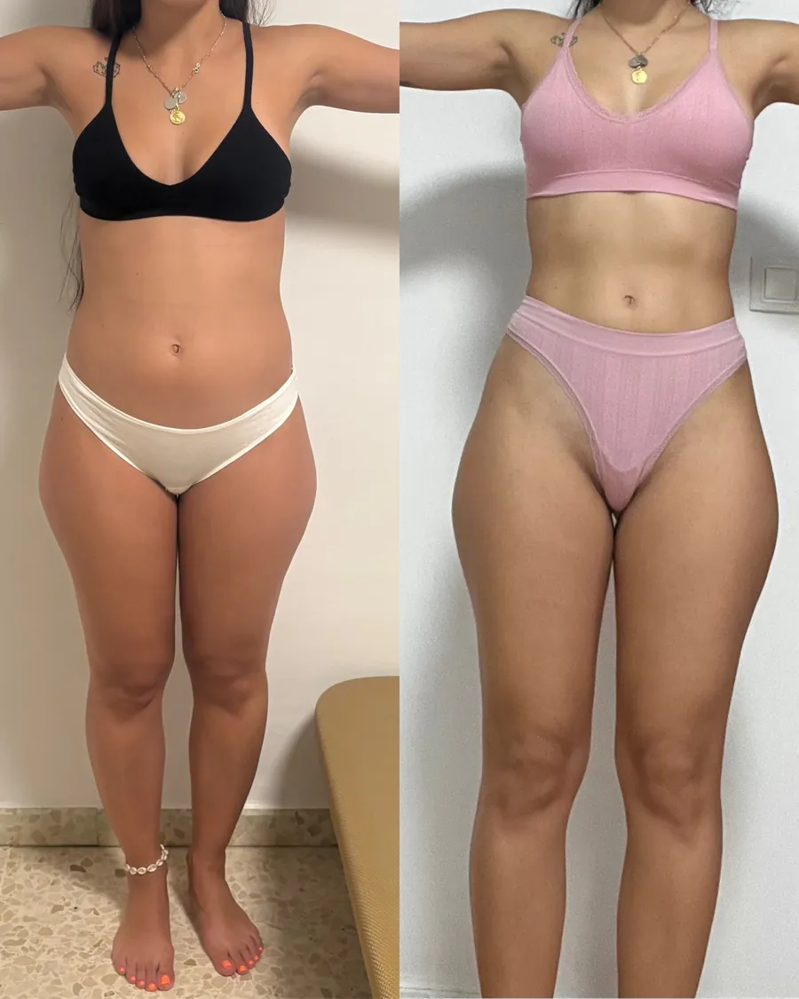 Antes y después de una clienta