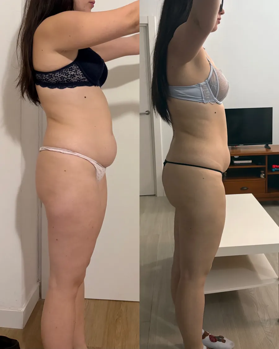 Antes y después de una clienta