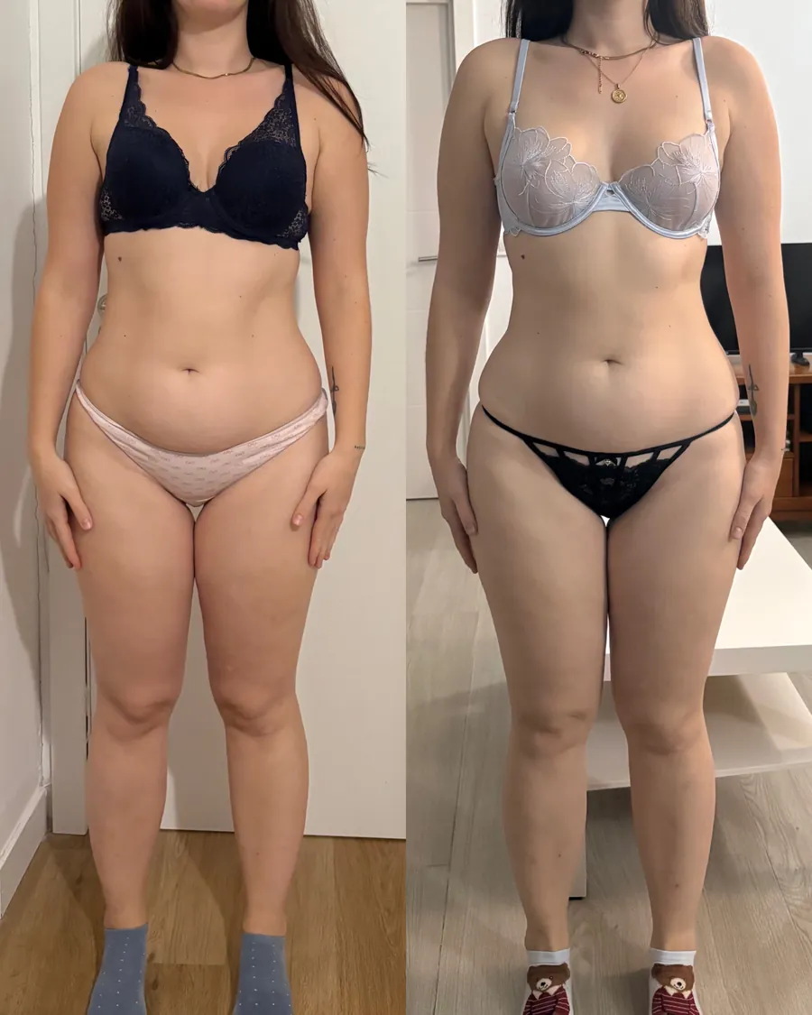 Antes y después de una clienta